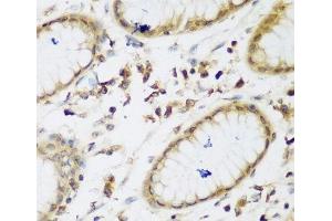 Immunohistochemistry of paraffin-embedded Human gastric using UBE3A Polyclonal Antibody at dilution of 1:200 (40x lens). (ube3a Antikörper)