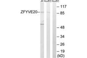 Western blot analysis of extracts from HuvEc/Jurkat cells, using ZFYVE20 Antibody. (Rabenosyn 5 Antikörper  (AA 145-194))