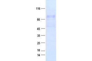 IDUA Protein (Myc-DYKDDDDK Tag)