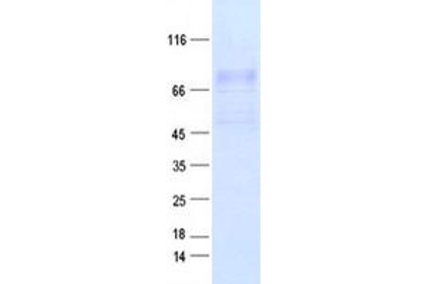 IDUA Protein (Myc-DYKDDDDK Tag)