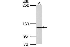 Western Blotting (WB) image for anti-Polymerase (DNA Directed), delta 1, Catalytic Subunit 125kDa (POLD1) (Center) antibody (ABIN2855506)