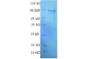 SDS-PAGE (SDS) image for Axonemal Outer Arm Dynein Intermediate Chain 1 (IC1) (AA 31-503), (partial) protein (His tag) (ABIN5710350) (Axonemal Outer Arm Dynein Intermediate Chain 1 Protein (IC1) (AA 31-503, partial) (His tag))