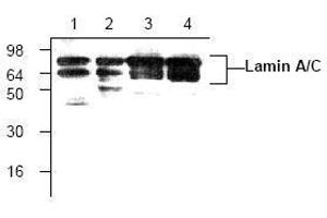 Image no. 1 for anti-Lamin A/C (LMNA) antibody (ABIN127068) (Lamin A/C Antikörper)
