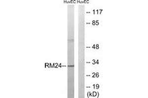 Western Blotting (WB) image for anti-Mitochondrial Ribosomal Protein L24 (MRPL24) (AA 101-150) antibody (ABIN2879173) (MRPL24 Antikörper  (AA 101-150))