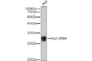 Western blot analysis of extracts of Raji cells, using HLA-DRB4 antibody (ABIN7268375) at 1:1000 dilution. (HLA-DRB4 Antikörper)