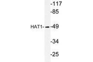 Western blot analysis of HAT1 antibody in extracts from LOVO cells. (HAT1 Antikörper)