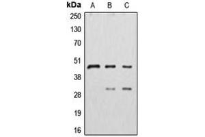 Western blot analysis of Cathepsin D expression in HepG2 (A), MDAMB231 (B), MCF7 (C) whole cell lysates. (Cathepsin D Antikörper  (Center))