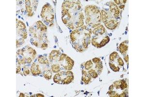 Immunohistochemistry of paraffin-embedded Human stomach using HDAC6 Polyclonal Antibody at dilution of 1:100 (40x lens). (HDAC6 Antikörper)