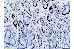 Formalin-fixed and paraffin embedded human gastric parietal cells labeled with Anti-Gastrin Polyclonal Antibody, Unconjugated (ABIN673119) followed by conjugation to the secondary antibody and DAB staining (Gastrin Antikörper  (AA 77-92))