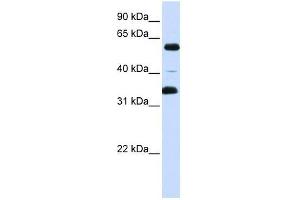 Western Blot showing ZKSCAN1 antibody used at a concentration of 1-2 ug/ml to detect its target protein. (ZKSCAN1 Antikörper  (Middle Region))