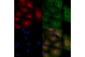 ABIN6256960 and ABIN6274918 staining  cells by IF/ICC. (BMP10 Antikörper  (Internal Region))