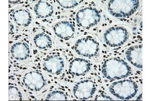 Image no. 2 for anti-TYRO3 Protein Tyrosine Kinase (TYRO3) antibody (ABIN1501608) (TYRO3 Antikörper)