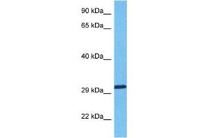 Host:  Rabbit  Target Name:  RBM7  Sample Tissue:  Human Lung Tumor  Antibody Dilution:  1ug/ml (RBM7 Antikörper  (Middle Region))