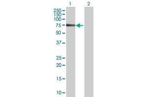Western Blotting (WB) image for MTM1 293T Cell Transient Overexpression Lysate(Denatured) (ABIN1332664)