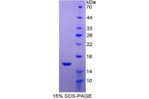 SDS-PAGE analysis of Human FABP7 Protein. (FABP7 Protein)