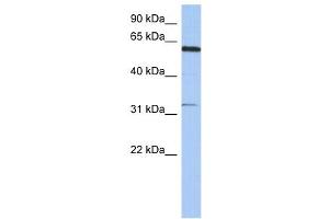 CDKL2 antibody used at 1 ug/ml to detect target protein. (CDKL2 Antikörper)