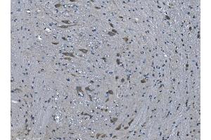 IHC analysis of TMPRSS3 using anti-TMPRSS3 antibody (ABIN7601198). (TMPRSS3 Antikörper  (AA 3-454))