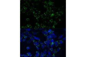 Immunofluorescence analysis of NIH-3T3 cells using GLUD1 antibody (ABIN6127975, ABIN6141157, ABIN6141158 and ABIN6223546) at dilution of 1:100. (GLUD1 Antikörper  (AA 54-240))