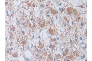 Immunohistochemistry (IHC) image for anti-Coagulation Factor VIII (F8) (AA 1887-2044) antibody (ABIN7438070)