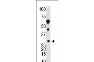 Antibody is used in Western blot to detect Recoverin in Y79 cell lysate. (Recoverin Antikörper  (C-Term))
