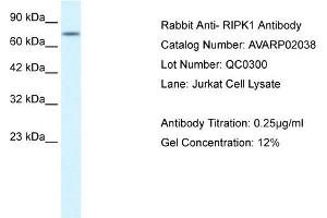 WB Suggested Anti-RIPK1  Antibody Titration: 0. (RIPK1 Antikörper  (Middle Region))