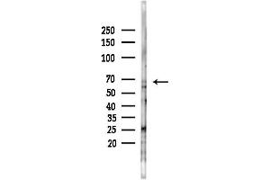 anti-Hedgehog Interacting Protein (HHIP) (C-Term) antibody