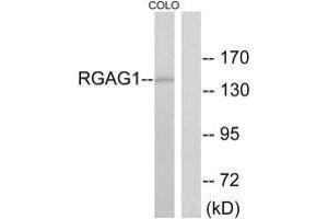 Western blot analysis of extracts from COLO cells, using RGAG1 antibody. (Retrotransposon Gag-Like Protein 9 (RTL9) (C-Term) Antikörper)
