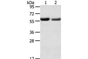 Western Blot analysis of Human normal stomach and stomach cancer tissue using SLC16A9 Polyclonal Antibody at dilution of 1:200 (SLC16A9 Antikörper)