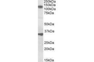 Western Blotting (WB) image for anti-Cell Division Cycle and Apoptosis Regulator 1 (CCAR1) (Internal Region) antibody (ABIN2464383) (CCAR1 Antikörper  (Internal Region))