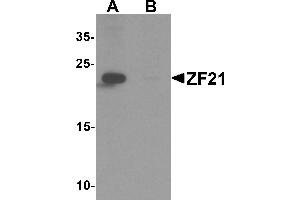 Western blot analysis of ZF21 in 3T3 cell tissue lysate with ZF21 antibody at 1 µg/mL in (A) the absence and (B) the presence of blocking peptide. (ZFYVE21 Antikörper  (N-Term))