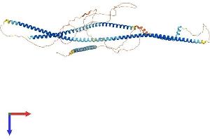 LRRFIP2 Protein (AA 1-721) (His tag)