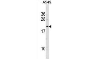 Western Blotting (WB) image for anti-Flavin Reductase (BLVRB) antibody (ABIN3001274)