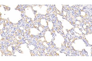 Immunohistochemistry (IHC) image for anti-Hemoglobin antibody (ABIN7437236)
