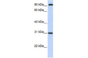 ANKRA2 antibody used at 0. (ANKRA2 Antikörper  (C-Term))