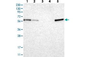 Western blot analysis of Lane 1: RT-4, Lane 2: U-251 MG, Lane 3: Human Plasma, Lane 4: Liver, Lane 5: Tonsil with TXNDC10 polyclonal antibody . (TMX3 Antikörper)