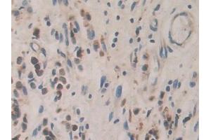 Immunohistochemistry (IHC) image for anti-Cadherin-16 (CDH16) (AA 37-287) antibody (ABIN7434509)