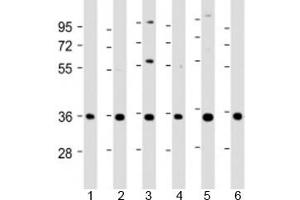 Western blot testing of human 1) A431, 2) HeLa, 3) HepG2, 4) Jurkat, 5) U-2OS and 6) SH-SY5Y cell lysate with NT5C3 antibody at 1:2000. (NT5C3 Antikörper  (AA 282-313))