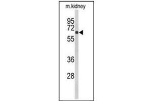 Western blot analysis of CYP27B1 Antibody (C-term)  in mouse kidney tissue lysates (35ug/lane).