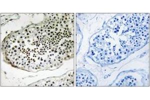 Immunohistochemistry analysis of paraffin-embedded human testis tissue, using UBQLN3 Antibody. (Ubiquilin 3 Antikörper  (AA 271-320))