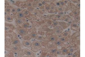 DAB staining on IHC-P; Samples: Human Liver Tissue (CYP26B1 Antikörper  (AA 1-512))