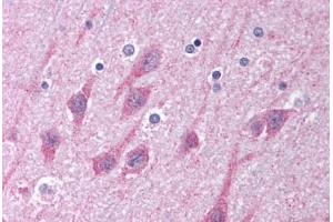 Human Brain, Cortex (formalin-fixed, paraffin-embedded) stained with TICAM1 antibody ABIN213993 at 5 ug/ml followed by biotinylated goat anti-rabbit IgG secondary antibody ABIN481713, alkaline phosphatase-streptavidin and chromogen. (TICAM1 Antikörper  (C-Term))