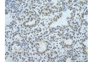 Rabbit Anti-HNRNPF Antibody       Paraffin Embedded Tissue:  Human alveolar cell   Cellular Data:  Epithelial cells of renal tubule  Antibody Concentration:   4. (HNRNPF Antikörper  (C-Term))