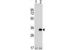 Western Blotting (WB) image for anti-Glutamate-Cysteine Ligase, Modifier Subunit (GCLM) (AA 245-274), (C-Term) antibody (ABIN952478)