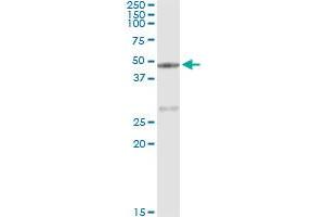 Immunoprecipitation of CPA1 transfected lysate using anti-CPA1 monoclonal antibody and Protein A Magnetic Bead , and immunoblotted with CPA1 MaxPab rabbit polyclonal antibody. (CPA1 Antikörper  (AA 1-419))