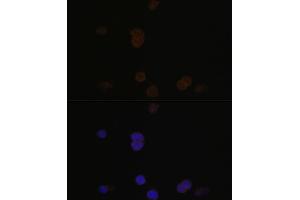 Immunofluorescence (IF) image for anti-Recoverin (RCVRN) (AA 1-200) antibody (ABIN6146832)