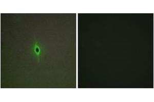 Immunofluorescence analysis of A549 cells, using 5-HT-2C Antibody. (HTR2C Antikörper  (AA 161-210))