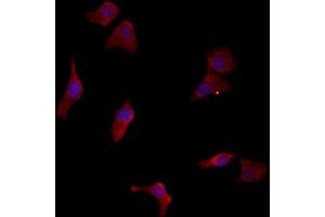 ABIN6262952 and ABIN6277129 staining HepG2 by IF/ICC. (LETMD1 Antikörper  (N-Term))