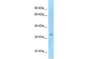 WB Suggested Anti-SAP30BP Antibody Titration: 1. (SAP30BP Antikörper  (N-Term))