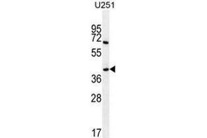 Western blot analysis in U251 cell line lysates (35ug/lane) using Proline-rich protein 16 / PRR16 Antibody (C-term). (PRR16 Antikörper  (C-Term))