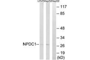 Western blot analysis of extracts from HepG2/LOVO cells, using NPDC1 Antibody.